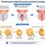 HOLEP Kamil Pocheć Urolog FEBU